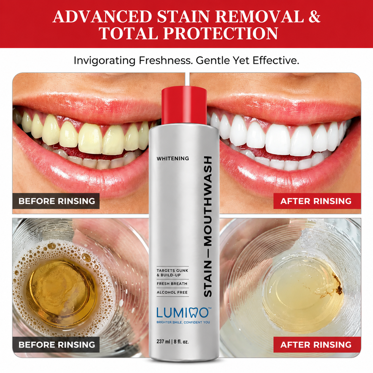 Brushing Isn’t Enough? Remove Hidden Stains & Buildup for a Brighter, Cleaner Smile